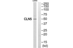 Western Blotting (WB) image for anti-Ceroid-Lipofuscinosis, Neuronal 5 (CLN5) (Internal Region) antibody (ABIN1851078) (CLN5 anticorps  (Internal Region))
