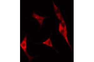 ABIN6274760 staining A549 cells by IF/ICC.