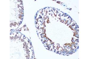 Immunohistochemistry of paraffin-embedded Mouse testis using MAP1LC3A Polyclonal Antibody at dilution of 1:100 (20x lens). (MAP1LC3A anticorps)
