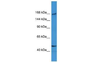 WB Suggested Anti-BTBD12 Antibody Titration: 0. (BTBD12 anticorps  (N-Term))