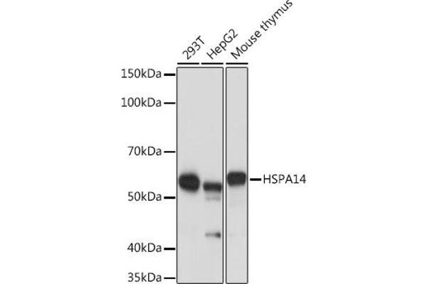 HSPA14 anticorps