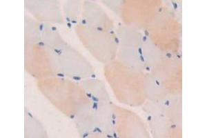 IHC-P analysis of Mouse Tissue, with DAB staining. (TNNT1 anticorps  (AA 1-261))