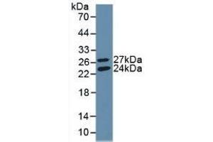 Detection of Recombinant GSS, Human using Polyclonal Antibody to Glutathione Synthetase (GSS) (Glutathione Synthetase anticorps  (AA 268-474))