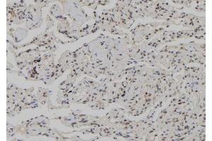 ABIN6272611 at 1/100 staining Human lung tissue by IHC-P.