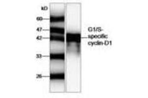 Image no. 1 for anti-Cyclin D1 (CCND1) antibody (ABIN791463) (Cyclin D1 anticorps)