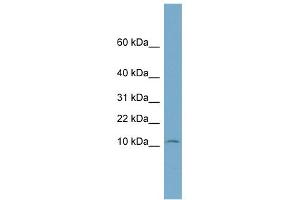 WB Suggested Anti-NOLA3 Antibody Titration: 0. (Nop10 anticorps  (Middle Region))