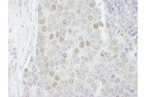 Immunohistochemistry (IHC) image for anti-RNA Binding Motif Protein 27 (RBM27) (AA 700-750) antibody (ABIN7448764) (RBM27 anticorps  (AA 700-750))