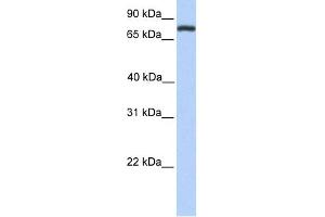 WB Suggested Anti-COLEC12 Antibody Titration:  0. (COLEC12 anticorps  (Middle Region))