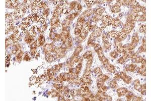 ABIN6268827 at 1/100 staining human liver tissue sections by IHC-P.
