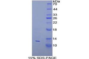 SDS-PAGE analysis of Human PEX2 Protein. (PEX2 Protéine)