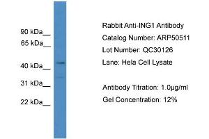 WB Suggested Anti-ING1  Antibody Titration: 0. (ING1 anticorps  (N-Term))