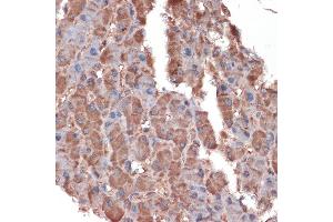 Immunohistochemistry of paraffin-embedded human liver using Apolipoprotein C3 Rabbit mAb (ABIN7265640) at dilution of 1:100 (40x lens). (APOC3 anticorps)