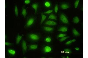 Immunofluorescence of monoclonal antibody to NPEPL1 on HeLa cell.