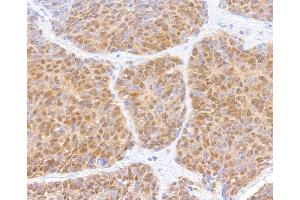 Immunohistochemistry (IHC) image for anti-SMAD, Mothers Against DPP Homolog 2 (SMAD2) (AA 225-275) antibody (ABIN7454016)