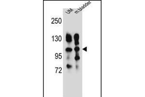ITGA5 Antibody (Center) (ABIN656138 and ABIN2845477) western blot analysis in human uterine tumor and mouse bladder tissue lysates (35 μg/lane). (ITGA5 anticorps  (AA 575-602))