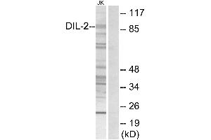 Immunohistochemistry analysis of paraffin-embedded human brain tissue using DIL-2 antibody. (TPX2 anticorps)