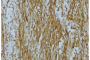 ABIN6275682 at 1/100 staining Mouse muscle tissue by IHC-P. (WASF2 anticorps  (Internal Region))
