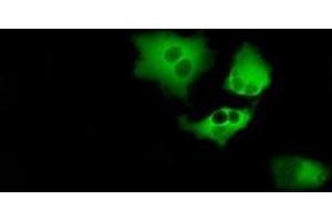 Image no. 6 for anti-Bruton Agammaglobulinemia tyrosine Kinase (BTK) antibody (ABIN1496972) (BTK anticorps)