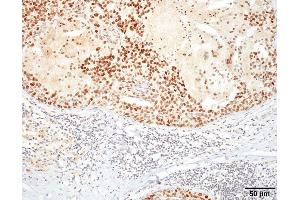 Immunohistochemistry analysis using Rat Anti-HSF1 Monoclonal Antibody, Clone 10H4 . (HSF1 anticorps  (Atto 390))
