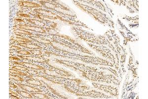 ABIN6265564 and ABIN6273020 at 1/100 staining Rat colon tissue by IHC-P. (TIA1 anticorps  (Internal Region))