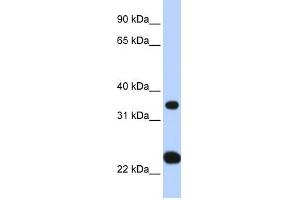 SLC25A35 antibody used at 1 ug/ml to detect target protein. (SLC25A35 anticorps  (N-Term))