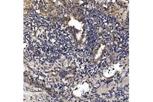 IHC analysis of Astrin/Deepest/SPAG5 using anti-Astrin/Deepest/SPAG5 antibody (ABIN7602399).