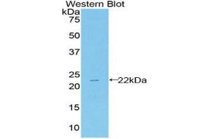 Western blot analysis of the recombinant protein. (HSPB2 anticorps  (AA 12-170))