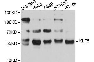 Western blot analysis of extracts of various cell lines, using KLF5 antibody (ABIN5971537) at 1/1000 dilution. (KLF5 anticorps)