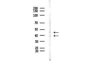 anti-Chromobox Homolog 6 (CBX6) (N-Term) antibody