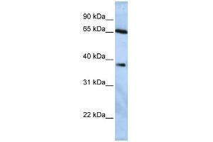 WB Suggested Anti-USP3 Antibody Titration:  0. (USP3 anticorps  (Middle Region))