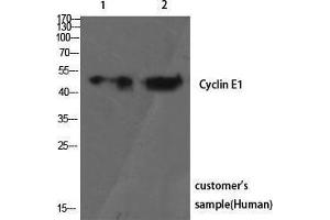 Western Blotting (WB) image for anti-Cyclin E1 (CCNE1) (Ser21) antibody (ABIN3174622) (Cyclin E1 anticorps  (Ser21))