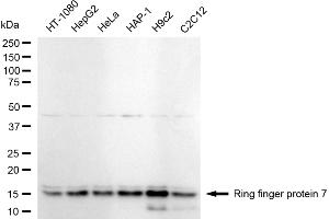 Western blotting analysis using ring finger protein 7 antibody (ABIN7800252).