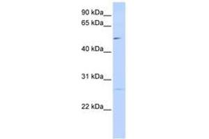 Image no. 1 for anti-Protein Phosphatase 1M (PP2C Domain Containing) (PPM1M) (AA 72-121) antibody (ABIN6741162) (PPM1M anticorps  (AA 72-121))