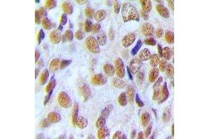 Immunohistochemistry (IHC) image for anti-U2 Small Nuclear RNA Auxiliary Factor 1 (U2AF1) antibody (ABIN7308460) (U2AF1 anticorps)