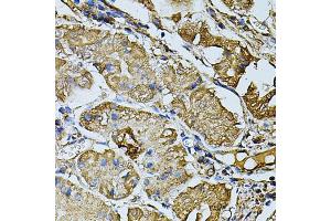 Immunohistochemistry of paraffin-embedded human stomach using CDH6 antibody (ABIN5974784) at dilution of 1/100 (40x lens). (CDH6 anticorps)