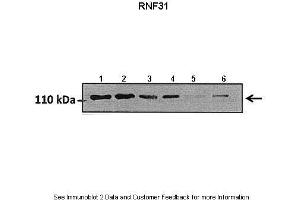 Lanes:   Lane1: 50 ug hormoxia A549 lysate Lane2: 50 ug hypoxia A549 lysate Lane3: 50 ug hormoxia A549 lysate (+scrambled siRNA) Lane4: 50 ug hypoxia A549 lysate (+scrambled siRNA) Lane5: 50 ug hormoxia A549 lysate (RNF31 siRNA) Lane6: 50 ug hypoxia A549 lysate (RNF31 siRNA)  Primary Antibody Dilution:   1:800  Secondary Antibody:   Goat anti rabbit HRP   Secondary Antibody Dilution:   1:10000  Gene Name:   RNF31  Submitted by:   Markus Queisser, Northwestern University (RNF31 anticorps  (Middle Region))