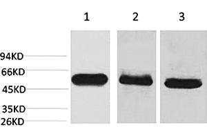 Western blot analysis of 1) Hela, 2) mouse brain tissue, 3) rat brain tissue using Caspase-8 Monoclonal Antibody.