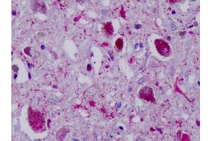 Anti-PPYR1 antibody IHC of human brain, substantia nigra. (NPY4R anticorps  (Cytoplasmic Domain))