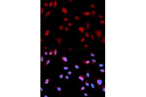 Immunofluorescence analysis of MCF-7 cells using Phospho-ABL1-Y204 antibody (ABIN5969866). (ABL1 anticorps  (pTyr204))