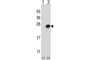 Western blot analysis of MGMT (arrow) using rabbit polyclonal MGMT Antibody (N-term). (MGMT anticorps  (N-Term))
