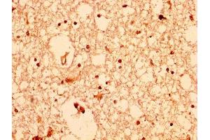 IHC image of ABIN7167024 diluted at 1:200 and staining in paraffin-embedded human brain tissue performed on a Leica BondTM system. (AKT1 anticorps  (AA 1-480))
