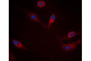 Immunofluorescent analysis of Alpha-synuclein (pS129) staining in HEK293T cells. (SNCA anticorps  (C-Term, pSer129))