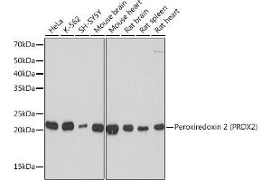 Western blot analysis of extracts of various cell lines, using Peroxiredoxin 2 (PRDX2) (PRDX2) Rabbit mAb (ABIN7269234) at 1:1000 dilution. (Peroxiredoxin 2 anticorps)