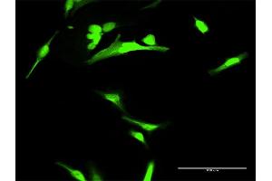 Immunofluorescence of purified MaxPab antibody to ANXA1 on HeLa cell.
