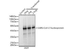Western blot analysis of extracts of normal 293T cells and 293T transfected with Nucleoprotein Protein, using SARS-CoV-2 Nucleoprotein antibody (ABIN7269052) at 1:10000 dilution. (Nucleoprotein anticorps)