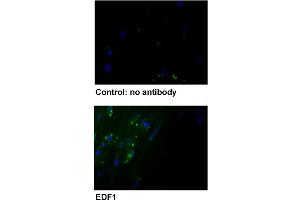 Immunofluorescent staining of human fibroblast with EDF1 polyclonal antibody . (EDF1 anticorps  (AA 99-148))