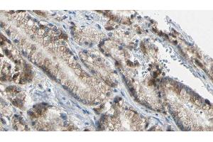 ABIN6276636 at 1/100 staining Human prostate tissue by IHC-P. (TNFRSF10B anticorps  (N-Term))