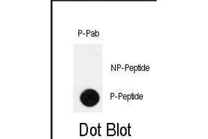 Dot blot analysis of anti-Phospho-IPF-pT11 Antibody (ABIN390000 and ABIN2839777) on nitrocellulose membrane. (PDX1 anticorps  (pThr11))