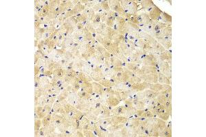 Immunohistochemistry of paraffin-embedded mouse heart using IDH1 antibody at dilution of 1:100 (400x lens). (IDH1 anticorps)