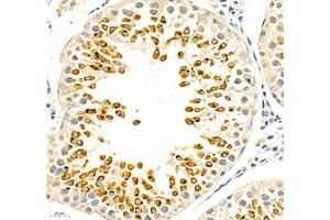 Immunohistochemistry of paraffin embedded rat testis using IP3R1 (ABIN7074293) at dilution of 1: 2400 (400x lens)